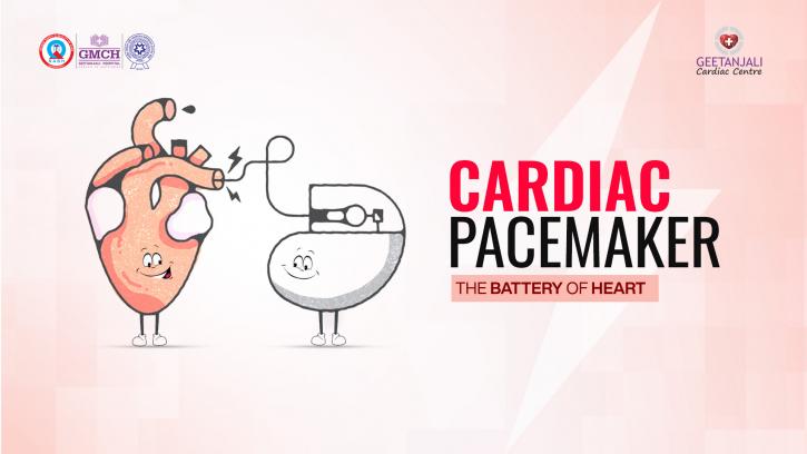 Cardiac Pacemaker 