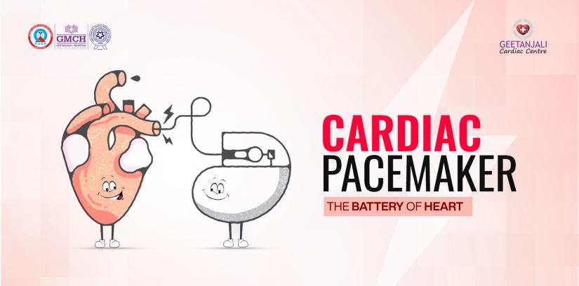 Cardiac Pacemaker 