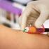 Importance of Pediatric Surgeries and Routine Checkups