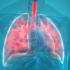 Pneumonia – a common illness in winter! How to take care of a patient suffering from Pneumonia?